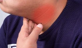 甲亢可以吃哈米瓜吗,哈密瓜的适宜摄入与注意事项